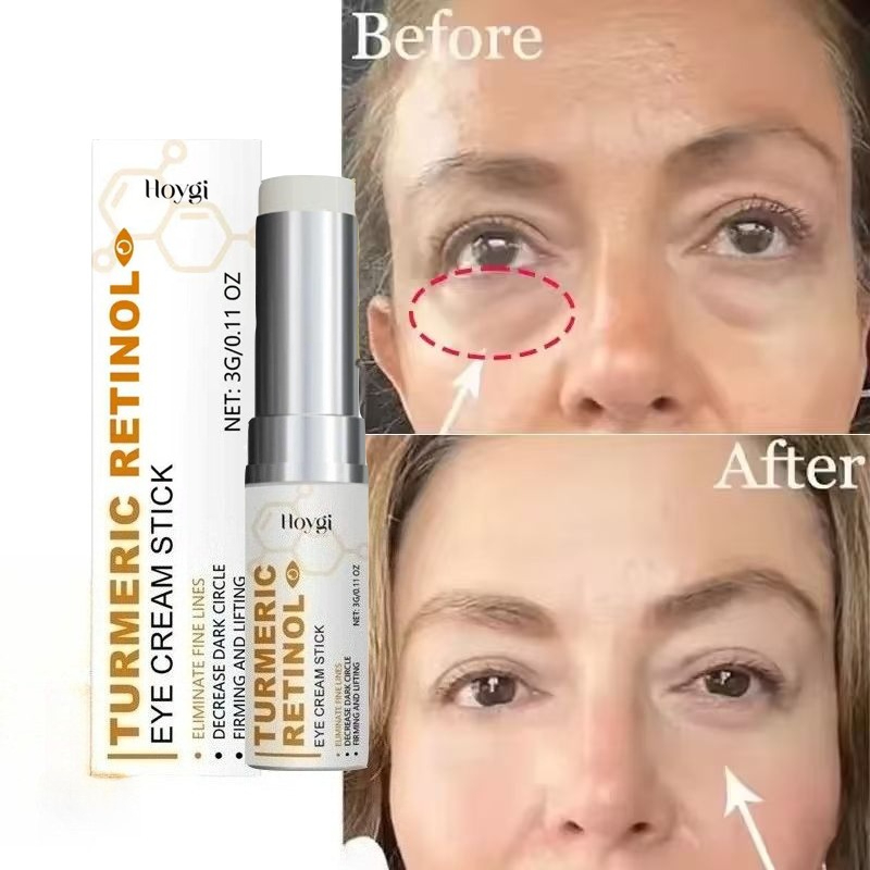 Retinol Anti Wrinkle Cream - كريم فوري لإزالة انتفاخات العين بالكركم