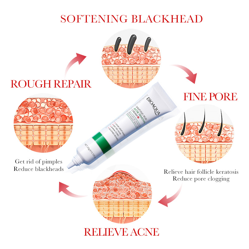 1/2/3 قطعة BIOAQUA حمض الساليس - مراجعة Salicylic Acid Blackhead Remover وسعره