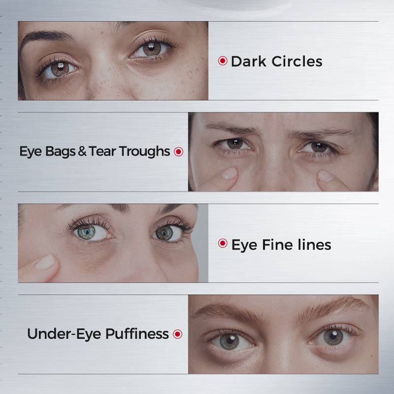 لصقات للعين لمعالجة الهالات ال - مراجعة Collagen Under Eye Patches وسعره
