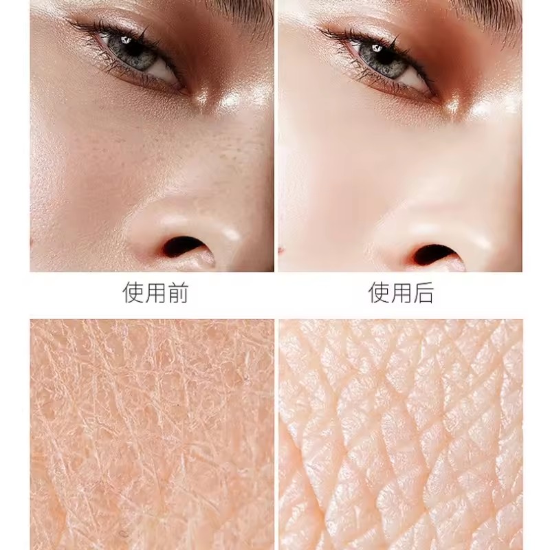 uronic Acid Niacinamide Essenc - مراجعة Niacinamide Pore Shrinking Essence وسعره