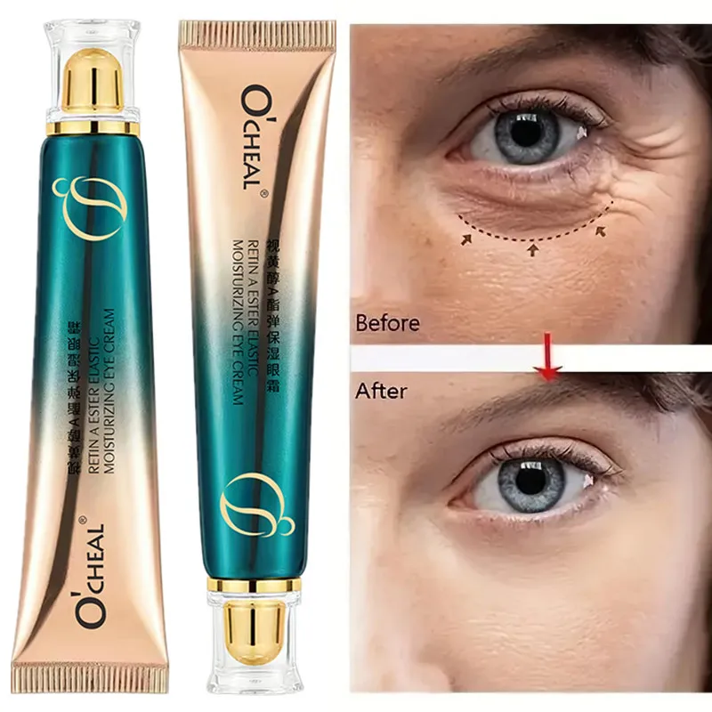 الريتينول تتلاشى الخطوط الدقيق - مراجعة Retinol Anti Wrinkle Cream وسعره