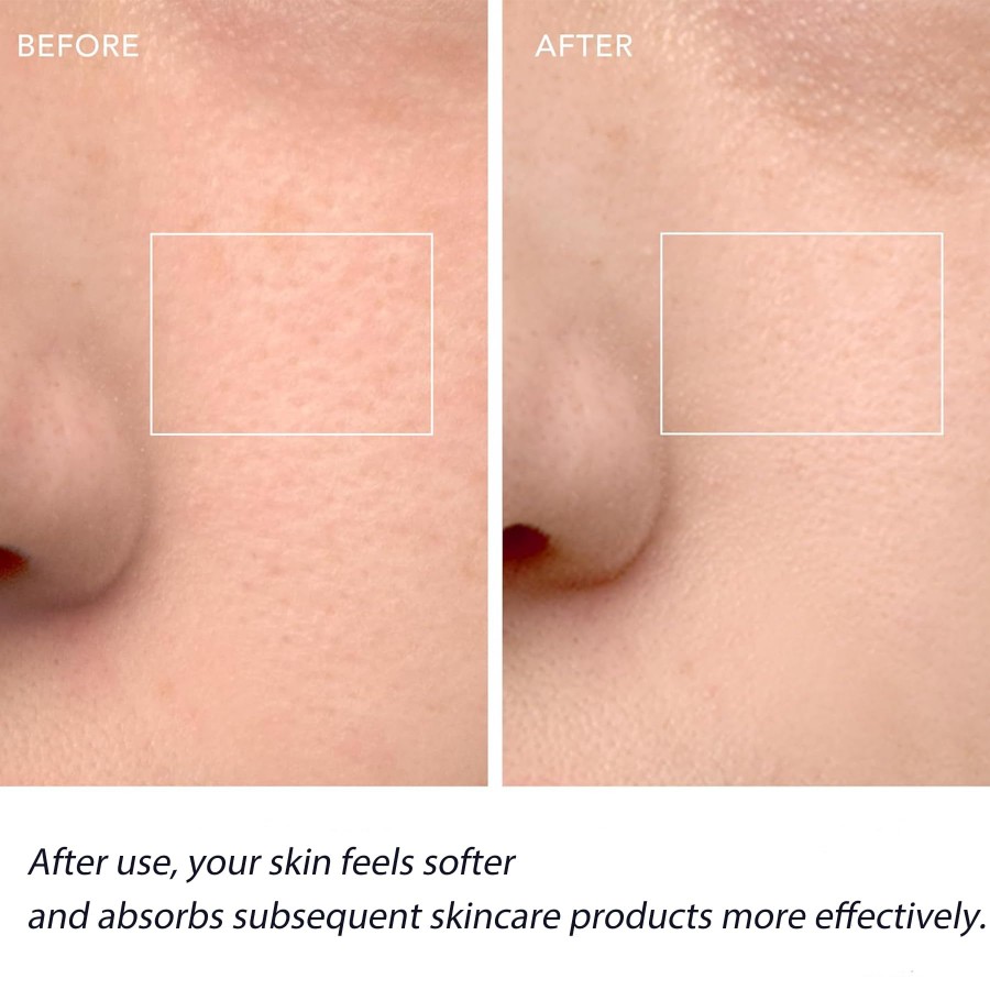 فرشاة تنظيف الوجه، فرشاة غسيل  - مراجعة Silicone Face Scrubber Electric وسعره