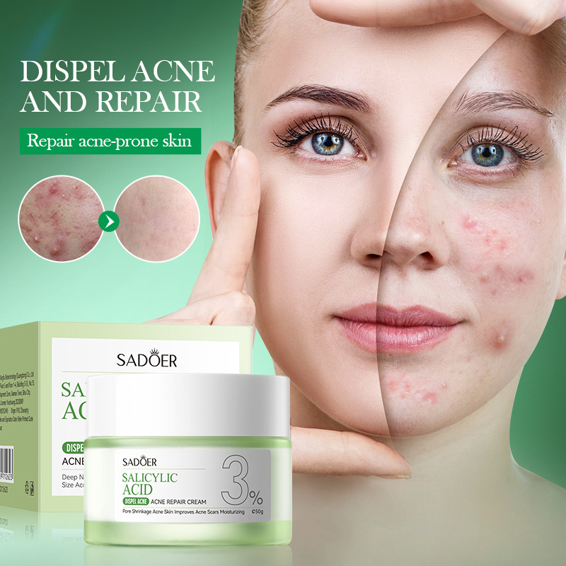 كريم علاج حب الشباب بحمض السال - مراجعة Salicylic Acid Blackhead Remover وسعره
