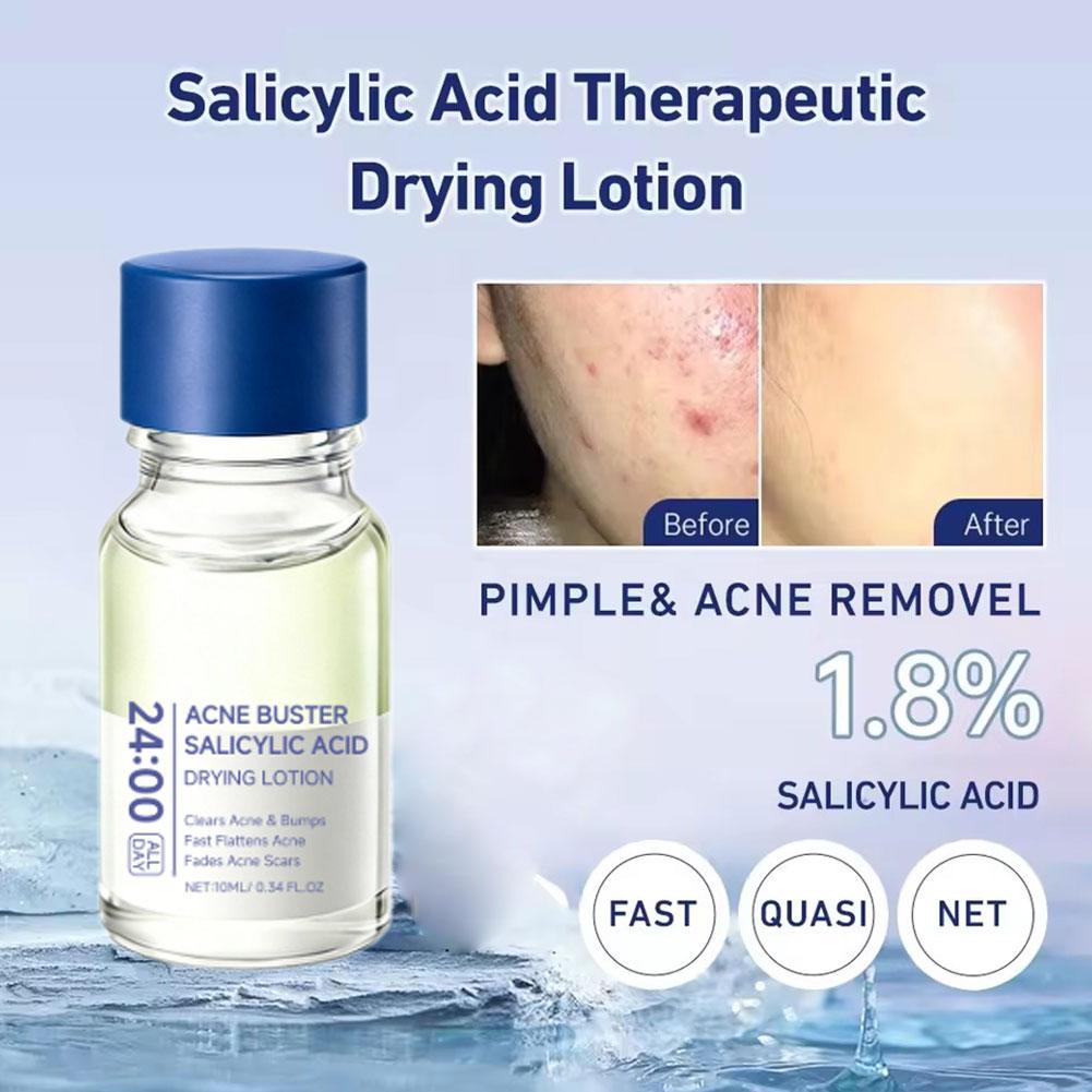 حمض الساليسيليك لإزالة حب الشب - مراجعة Salicylic Acid Blackhead Remover وسعره